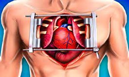 مراقبت بعد از عمل بای پس قلب